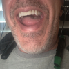 suckhole